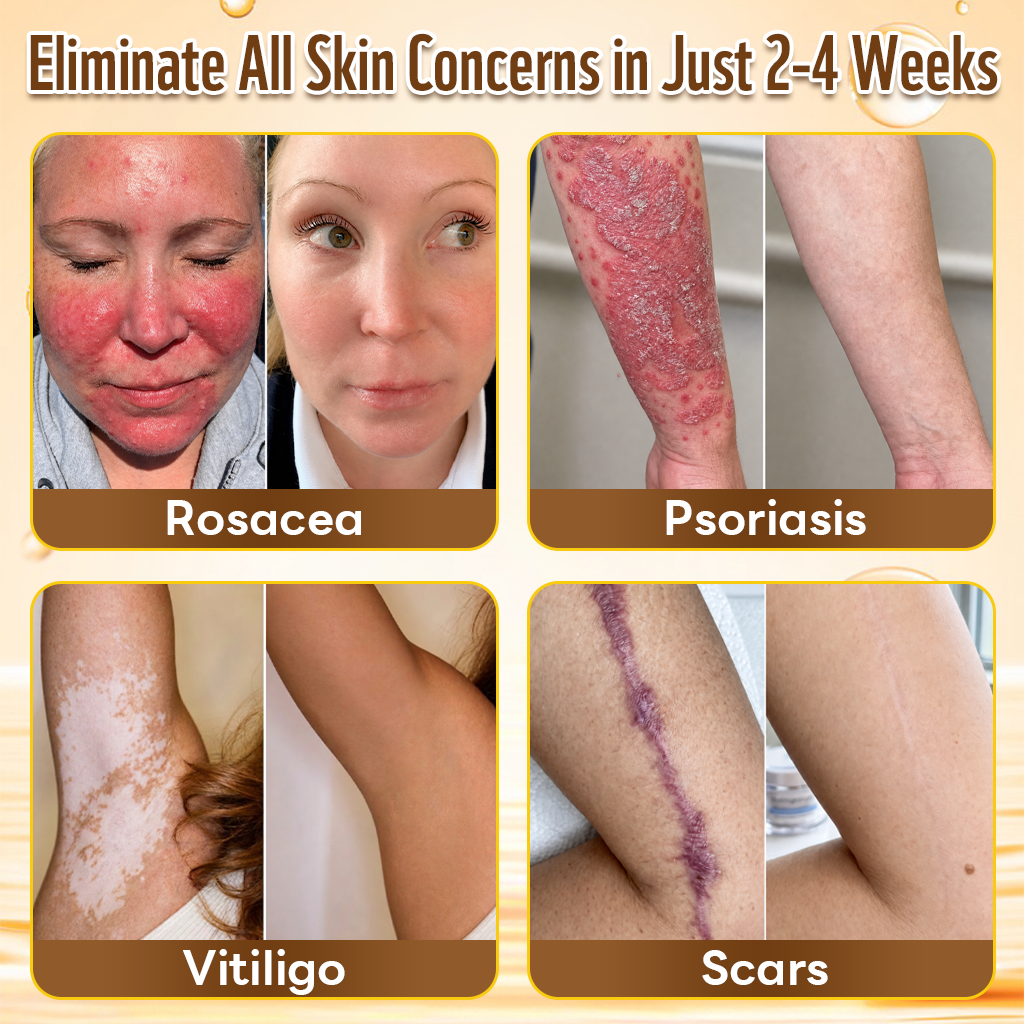 【EXCLUSIVE POST-CARE OFFER】 Target the Spot. Then Help Skin Look Smooth Again. HISKIN® Multi-Concern Skin Repair Cream