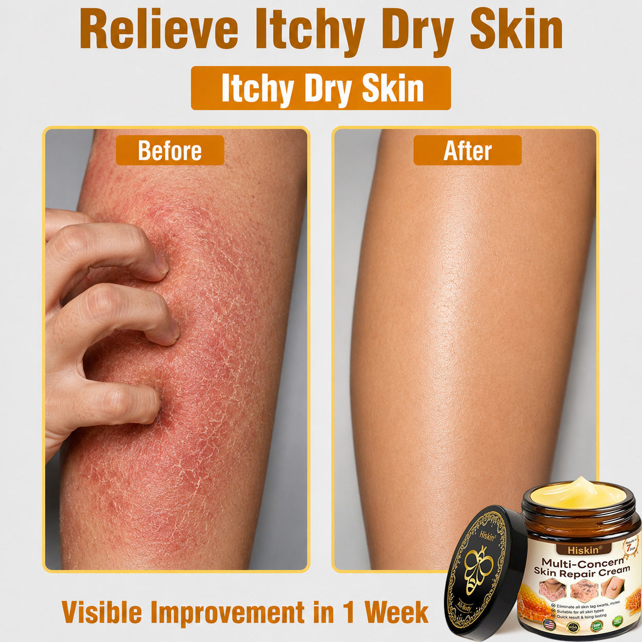 【EXCLUSIVE POST-CARE OFFER】 Target the Spot. Then Help Skin Look Smooth Again. HISKIN® Multi-Concern Skin Repair Cream