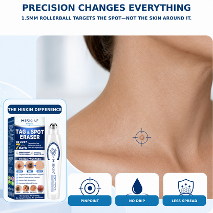 𝐇𝐈𝐒𝐊𝐈𝐍®👩‍⚕️ 𝟕-𝐃𝒂𝘆 𝐒𝗸𝐢𝐧 𝐓𝒂𝗴 & 𝐒𝐩𝙤𝐭 𝐄𝐫𝒂𝐬𝙚𝐫 Painless & Scar-Free Advanced Imperfection Removal Rollerball Pen