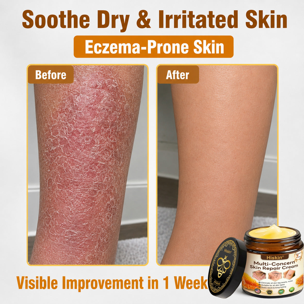 【EXCLUSIVE POST-CARE OFFER】 Target the Spot. Then Help Skin Look Smooth Again. HISKIN® Multi-Concern Skin Repair Cream