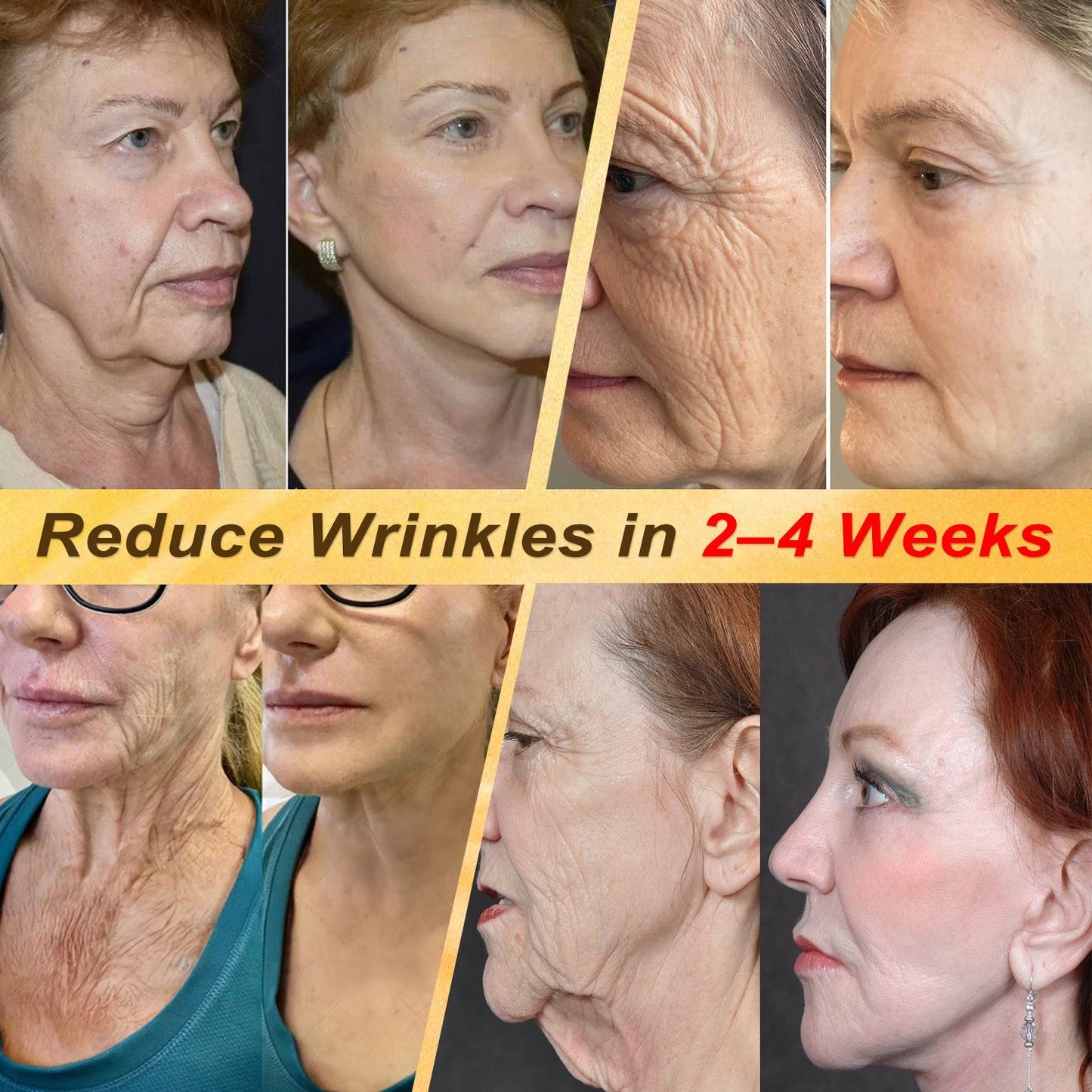 【EXCLUSIVE POST-CARE OFFER】 Target the Spot. Then Help Skin Look Smooth Again. HISKIN® Multi-Concern Skin Repair Cream