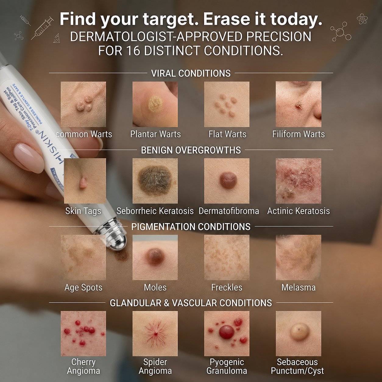 𝐇𝐈𝐒𝐊𝐈𝐍®👩‍⚕️【30%OFF only today】 𝟕-𝐃𝒂𝘆 𝐒𝗸𝐢𝐧 𝐓𝒂𝗴 & 𝐒𝐩𝙤𝐭 𝐄𝐫𝒂𝐬𝙚𝐫 Painless & Scar-Free Advanced Imperfection Removal Rollerball Pen