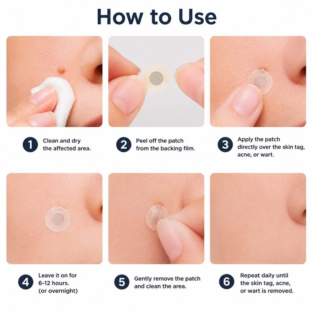 ✨Hiskin ® 2-in-1 Microneedle & Hydrocolloid Patch🍀 | Removes raised moles, acne, flat warts, and skin tags | Helps improve wrinkles, scars, and blemishes | Invisible patches for face and body