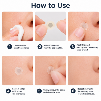 ✨Hiskin ® 2-in-1 Microneedle & Hydrocolloid Patch🍀 | Removes raised moles, acne, flat warts, and skin tags | Helps improve wrinkles, scars, and blemishes | Invisible patches for face and body