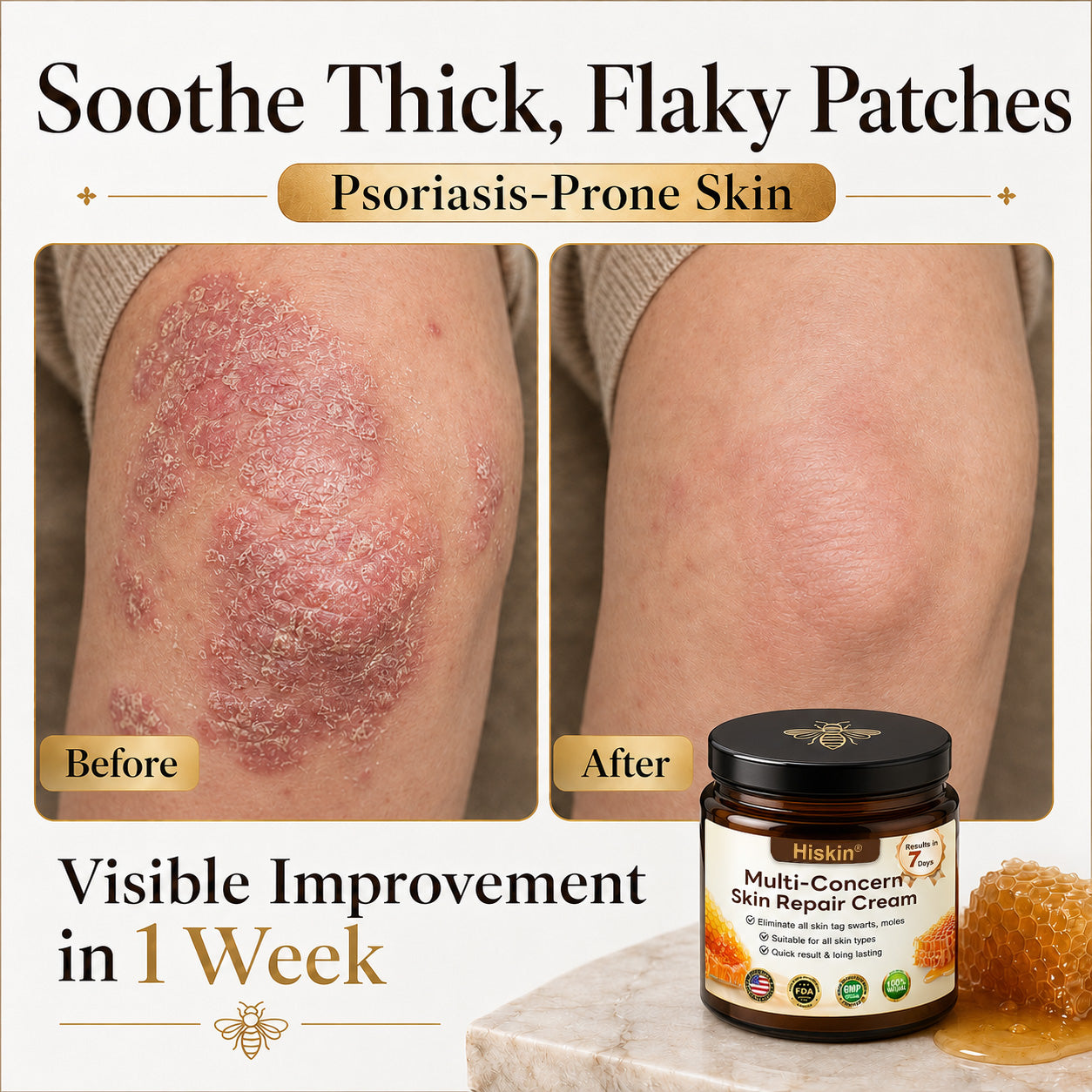 【EXCLUSIVE POST-CARE OFFER】 Target the Spot. Then Help Skin Look Smooth Again. HISKIN® Multi-Concern Skin Repair Cream