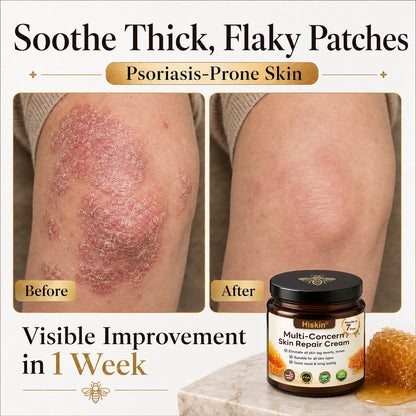 【EXCLUSIVE POST-CARE OFFER】 Target the Spot. Then Help Skin Look Smooth Again. HISKIN® Multi-Concern Skin Repair Cream