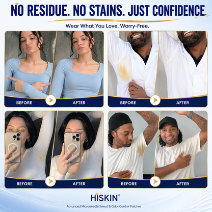 Hiskin® 2-in-1 Advanced Sweat Control & Deodorant Microneedle Patches — For All Genders · Aluminum-Free · Natural Odor Control