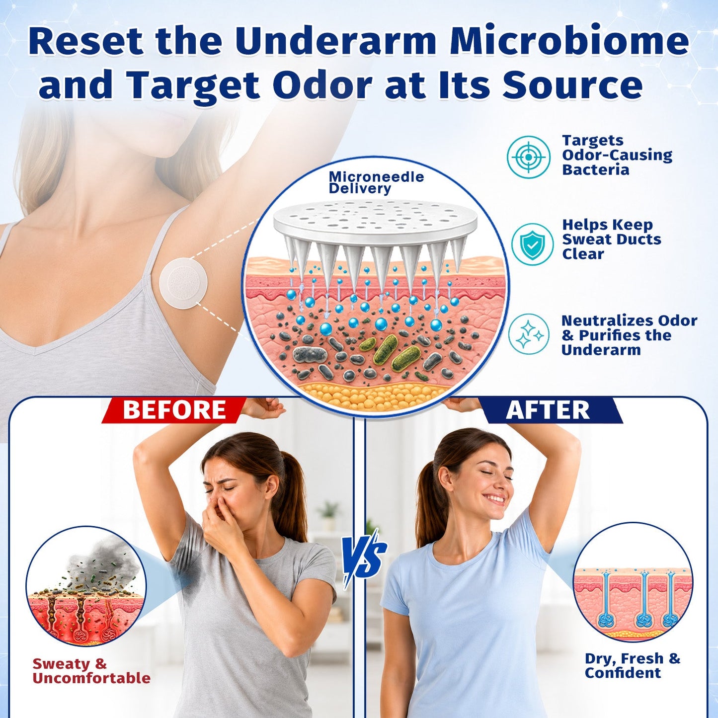 Hiskin® 2-in-1 Advanced Sweat Control & Deodorant Microneedle Patches — For All Genders · Aluminum-Free · Natural Odor Control