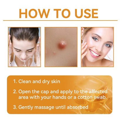 【EXCLUSIVE POST-CARE OFFER】 Target the Spot. Then Help Skin Look Smooth Again. HISKIN® Multi-Concern Skin Repair Cream