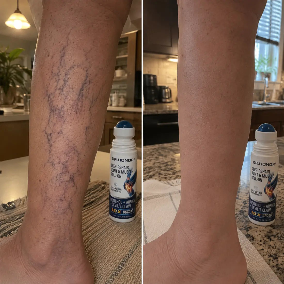 Lower-leg comparison with DR.HONOR roll-on