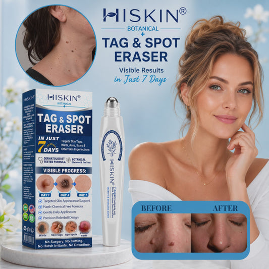𝐇𝐈𝐒𝐊𝐈𝐍®👩‍⚕️ 𝟕-𝐃𝒂𝘆 𝐒𝗸𝐢𝐧 𝐓𝒂𝗴 & 𝐒𝐩𝙤𝐭 𝐄𝐫𝒂𝐬𝙚𝐫 Painless & Scar-Free Advanced Imperfection Removal Rollerball Pen